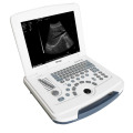 Mais barato display LED 3D ultra-som portátil e CE ISO aprovado tablet ultrasound máquina